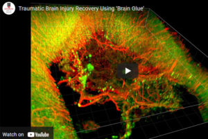 TBI Video screenshot