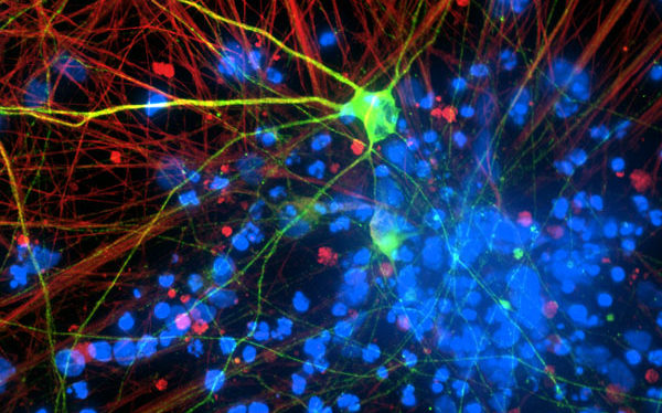 Stem Cell FAQs