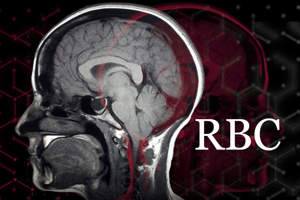 There are currently no FDA-approved drugs that directly repair or prevent brain damage following TBI, a major gap in treatment. (Illustration by Lindsay Robinson)